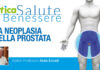 neoplasia prostata